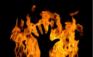 hand ins feuer legen